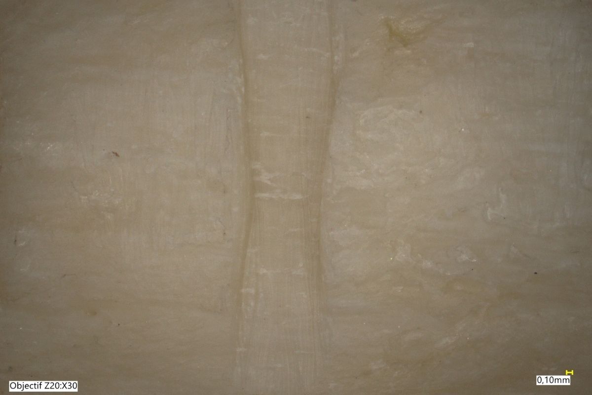 Traces de scie sur un os